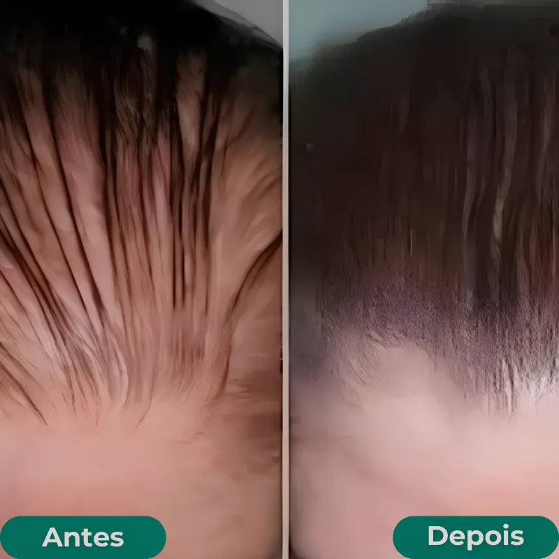 Paralisa a Queda e Acelera o Crescimento Capilar - Growth Hair