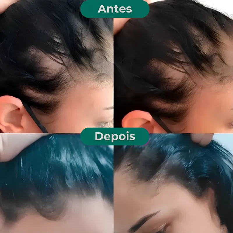 Paralisa a Queda e Acelera o Crescimento Capilar - Growth Hair